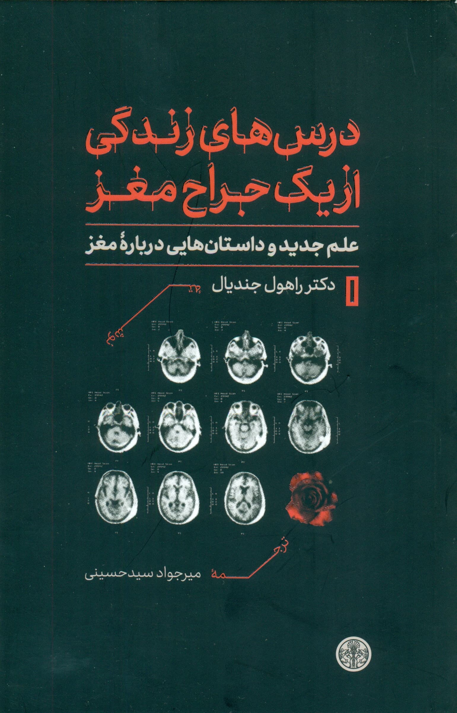 درسهای زندگی از 1 جراح مغز (علم جدید و داستانهایی درباره مغز)