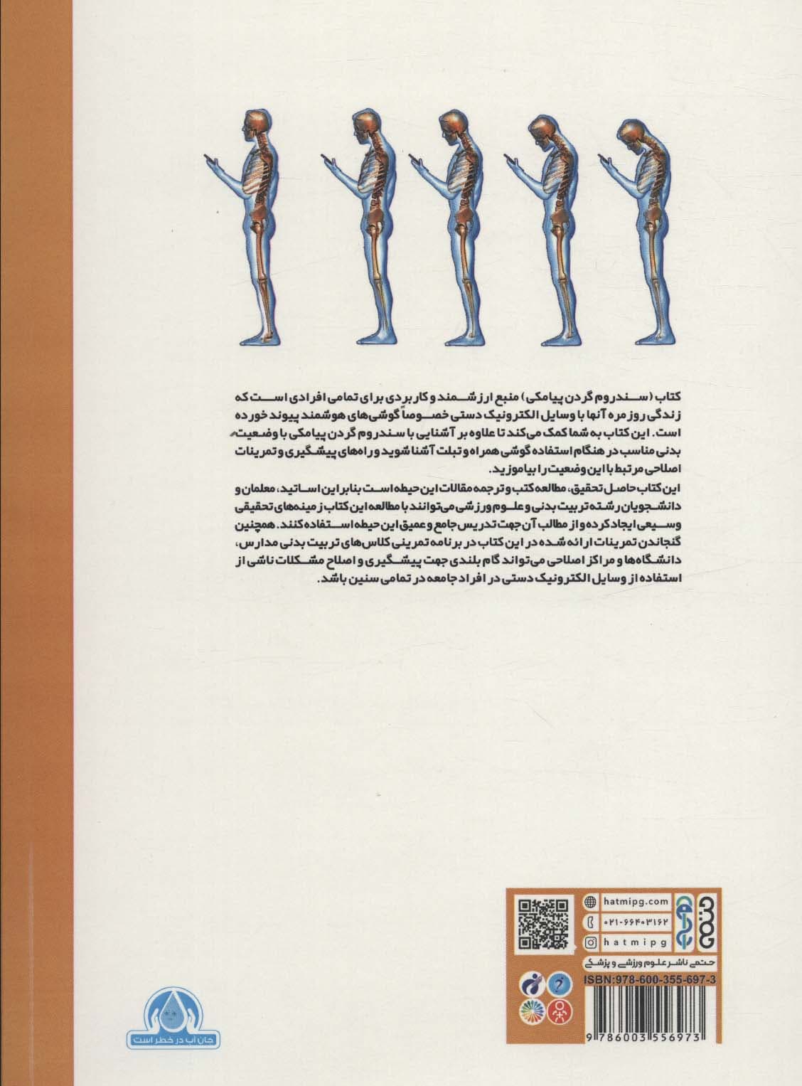 سندروم گردن پیامکی (چطور گوشی همراه باعث گردن درد می شود؟)