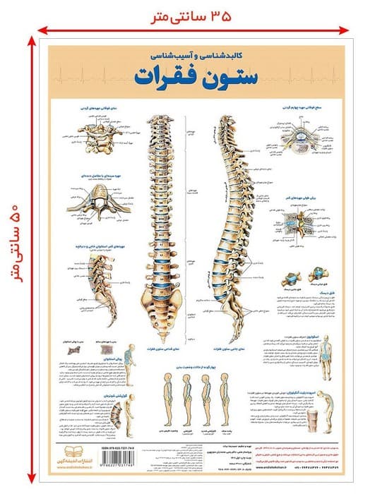 پوستر کالبد شناسی و آسیب شناسی ستون فقرات 50*35 (گلاسه،باجعبه)