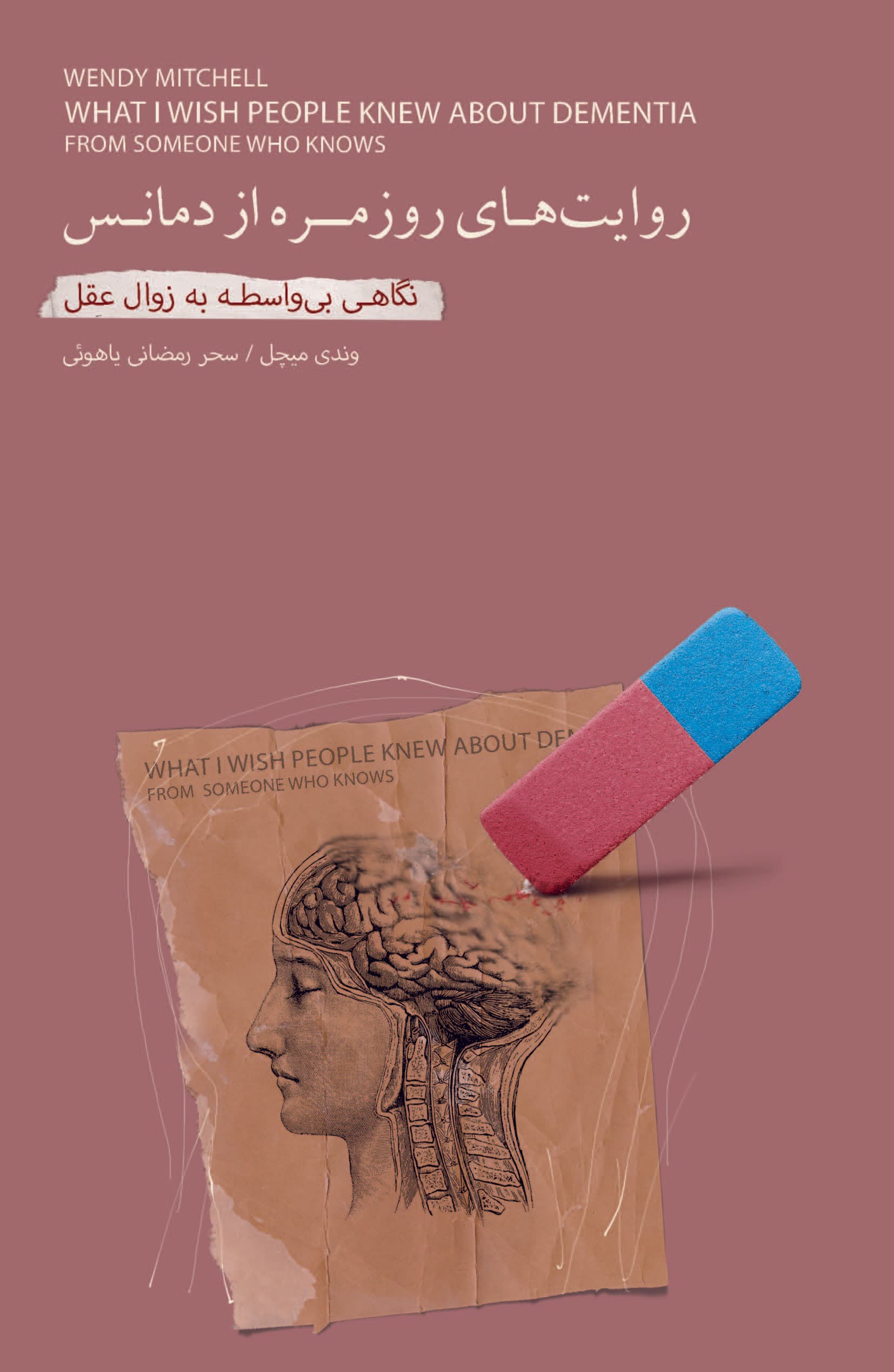 روایت‌های روزمره از دمانس (نگاهی بی‌واسطه به زوال عقل)