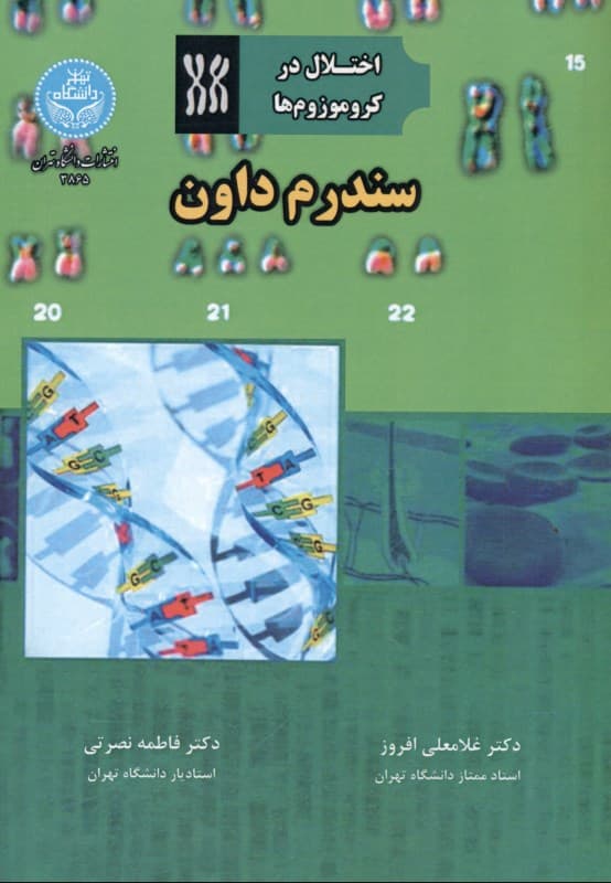 سندرم داون (اختلال در کروموزوم‌ها)